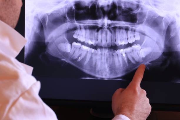 Best Urgent Tooth Repair  in St Bernard, OH