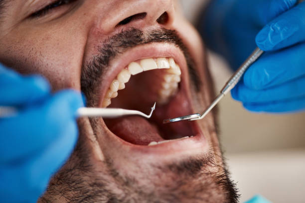 Best Knocked-Out Tooth Emergency  in St Bernard, OH