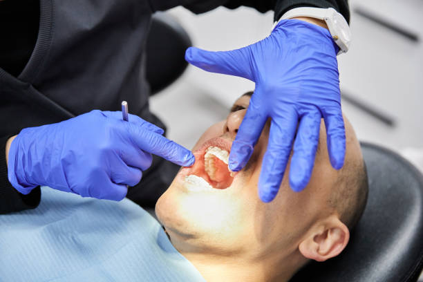 Best Tooth Infection Emergency Dentist  in St Bernard, OH